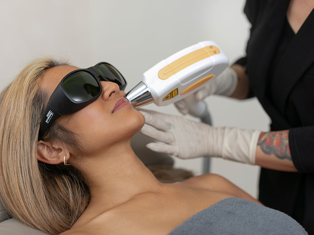 Gesicht dauerhafte Haarentfernung Laser PHR Sara Pavo Cosmetics Oberhausen