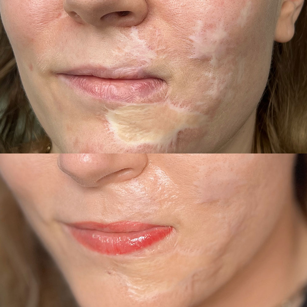 behandlungen-medizinische-taetowierung-permanentmakeup-pigmentierung-sarapavocosmetics-oberhausen